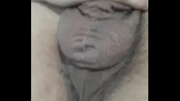 Hairy Balls